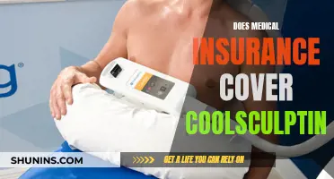 Medical Insurance and CoolSculpting: What's Covered?