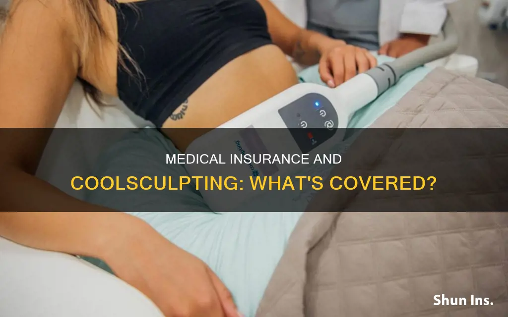 does medical insurance cover coolsculpting