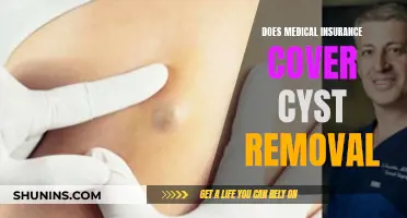 Medical Insurance and Cyst Removal: What's Covered?