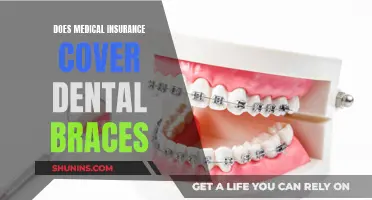 Medical Insurance and Dental Braces: What's Covered?