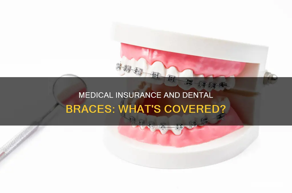 does medical insurance cover dental braces