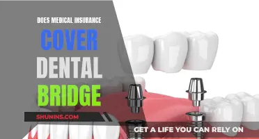 Dental Bridge Coverage: Understanding Your Medical Insurance Options
