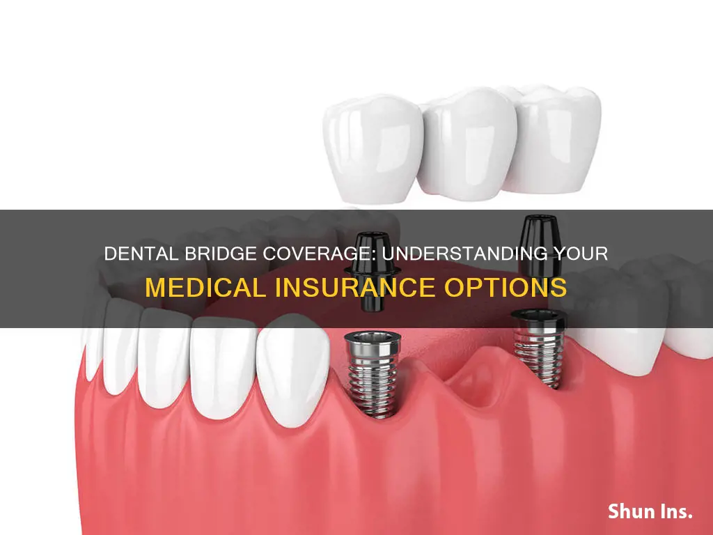 does medical insurance cover dental bridge