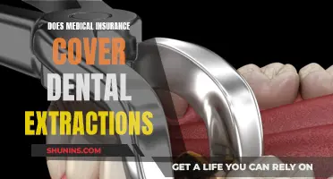 Dental Extractions: Are They Covered by Medical Insurance?