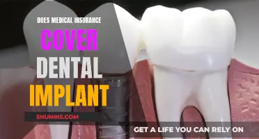 Dental Implants: Are They Covered by Medical Insurance?