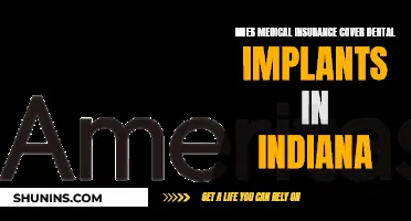Dental Implants: Medical Insurance Coverage in Indiana