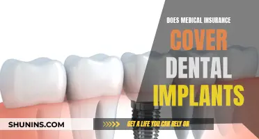 Dental Implants: Unlocking Coverage Secrets with Medical Insurance