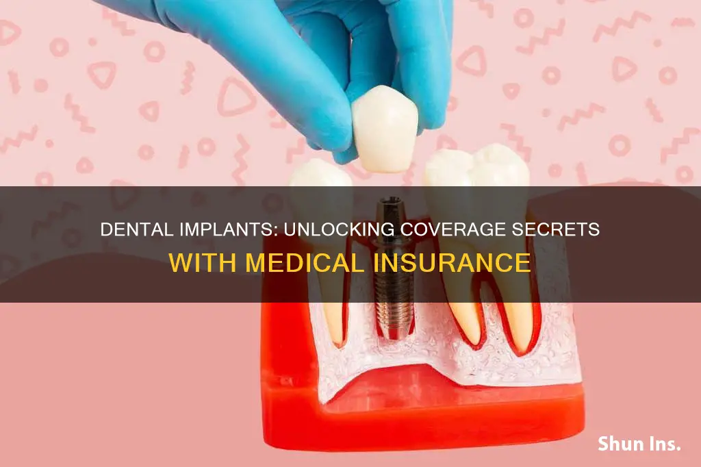 does medical insurance cover dental implants