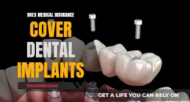 Dental Implants: Are They Covered by Medical Insurance?