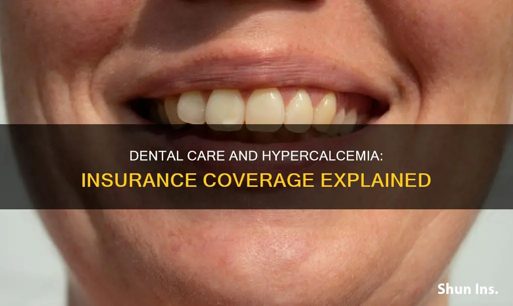 does medical insurance cover dental issues from hypercalcemia