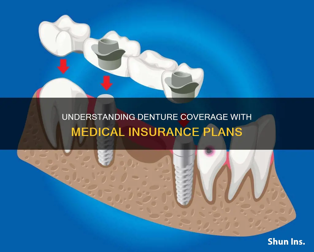 does medical insurance cover dentures