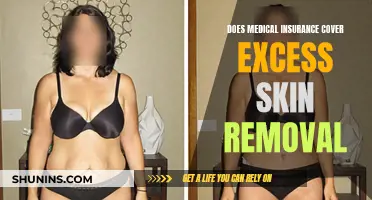 Medical Insurance and Excess Skin Removal: What's Covered?