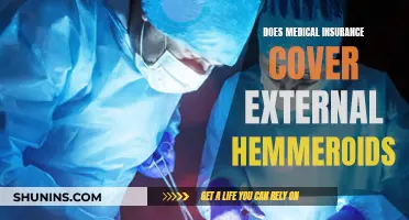 External Hemorrhoids: Are They Covered by Medical Insurance?