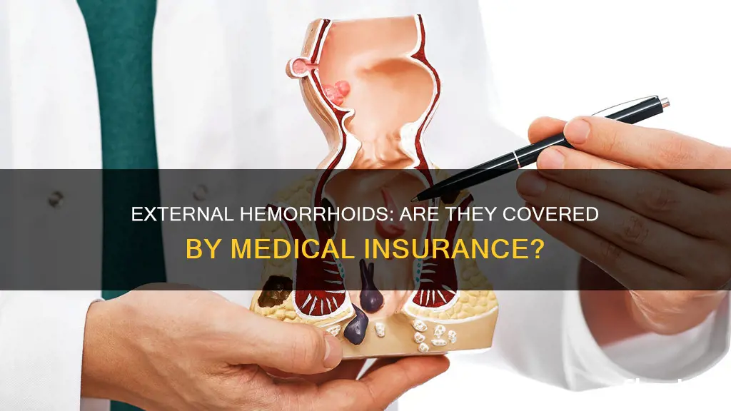 does medical insurance cover external hemmeroids