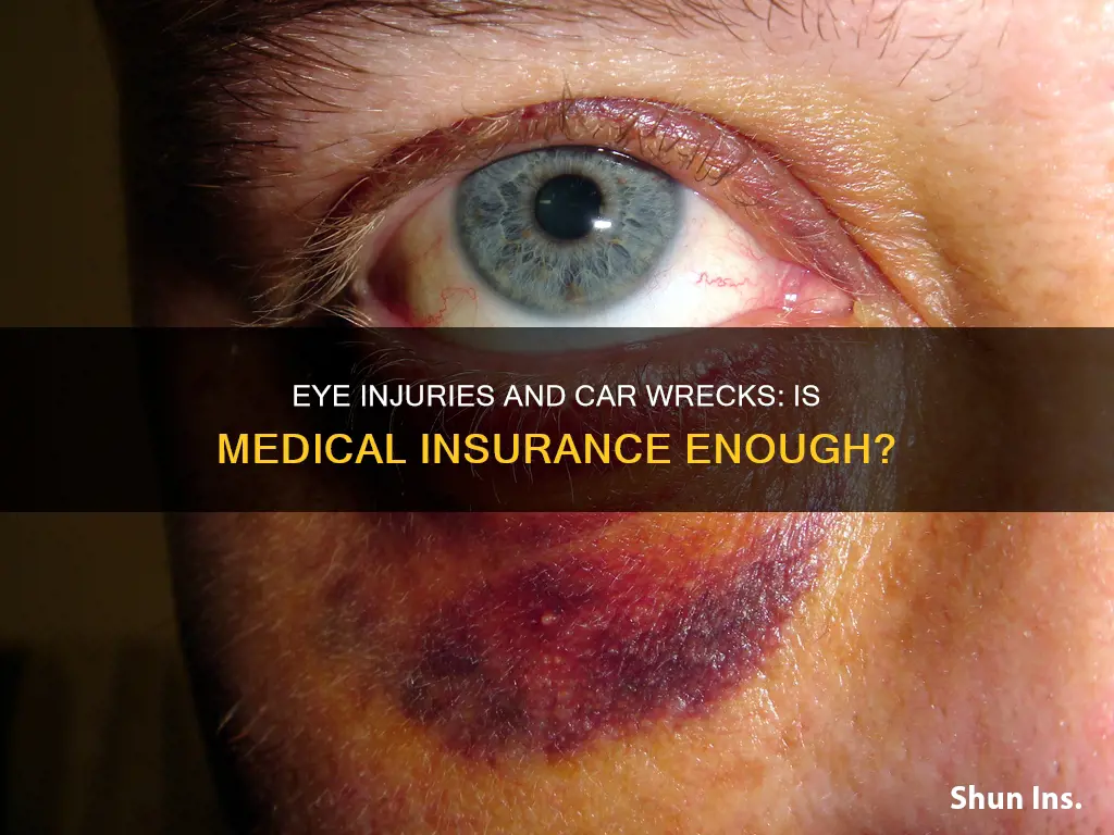 does medical insurance cover eyes if injured in a wreck