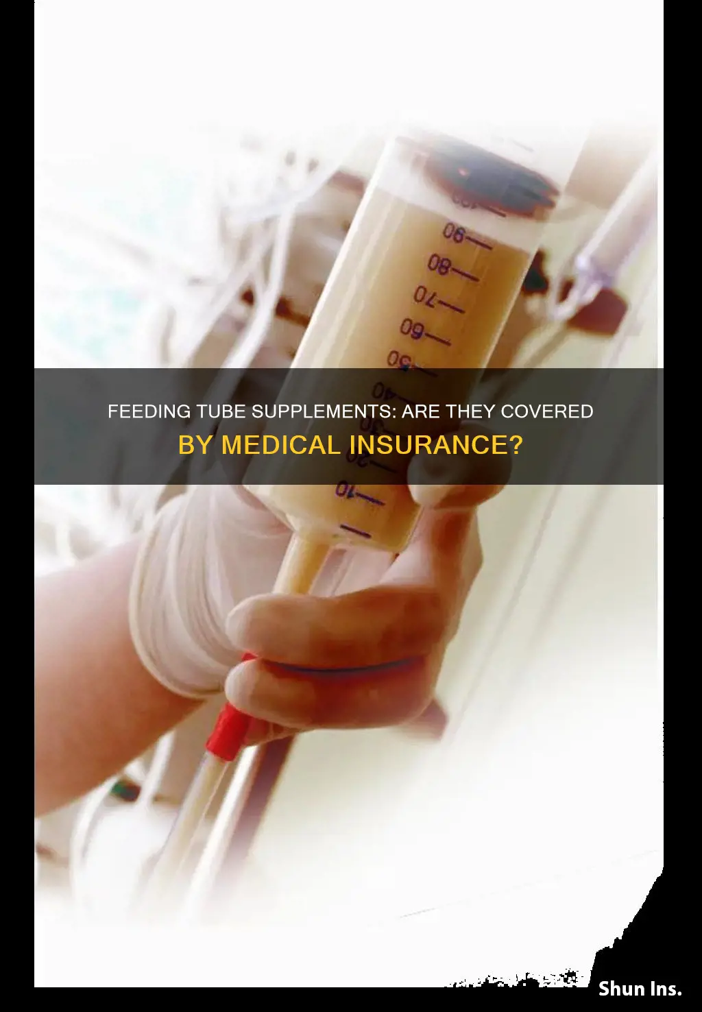 does medical insurance cover feeding tubes supplements