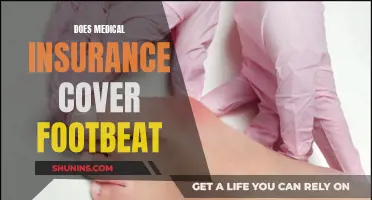 Footbeat and Medical Insurance: What's Covered?