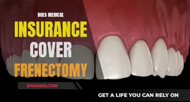 Medical Insurance and Frenectomy: What's Covered?