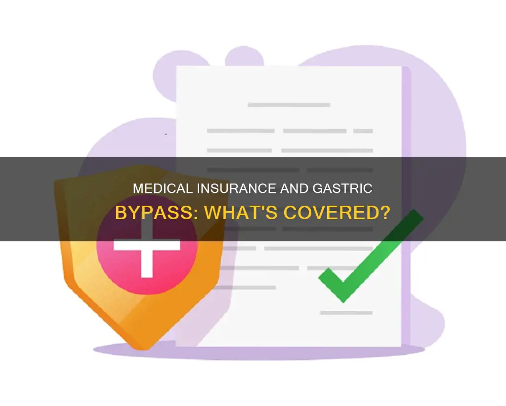 does medical insurance cover gastric bypass