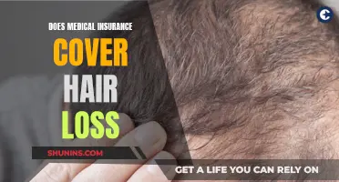 Hair Loss: Medical Insurance Coverage Explained