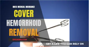 Medical Insurance and Hemorrhoid Removal: What's Covered?