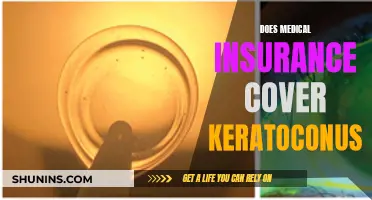 Keratoconus Treatment: What Does Medical Insurance Cover?