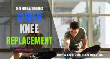 Knee Replacement: What Does Medical Insurance Cover?