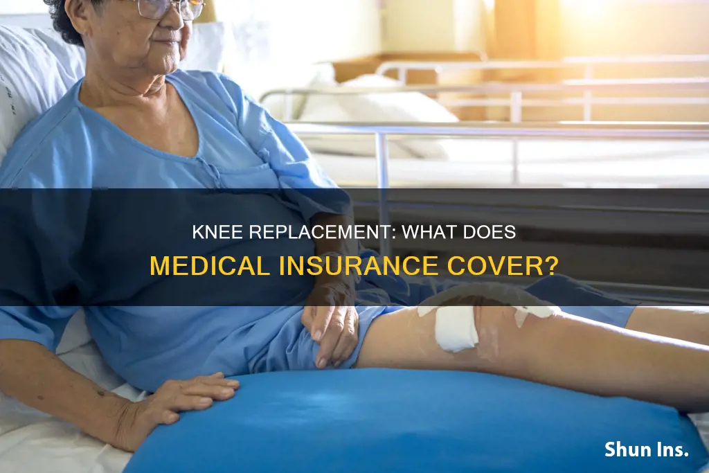 does medical insurance cover knee replacement