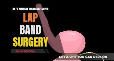 Lap-Band Surgery: Is Medical Insurance Coverage Available?