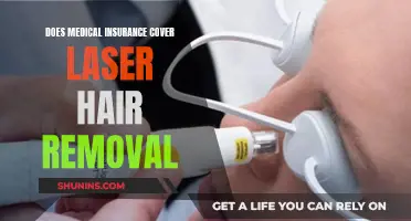 Laser Hair Removal: Is It Covered by Medical Insurance?