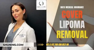 Lipoma Removal: Is Medical Insurance Coverage Available?