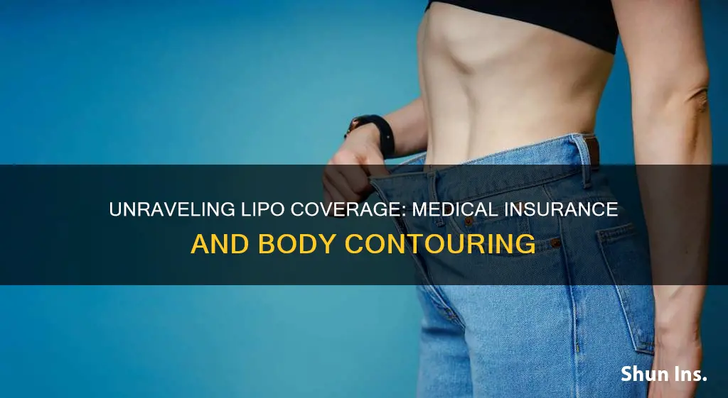 does medical insurance cover liposuction