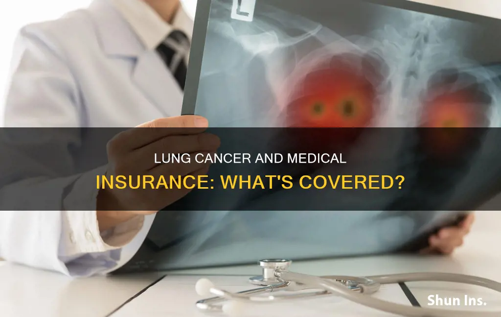 does medical insurance cover lung cancer