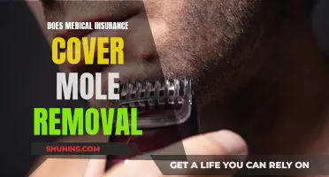 Medical Insurance and Mole Removal: What's Covered?