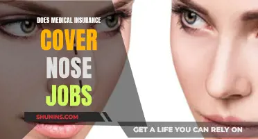 Medical Insurance Coverage for Nose Jobs: What's Included?