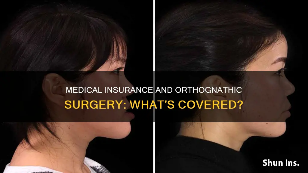 does medical insurance cover orthognathic surgery