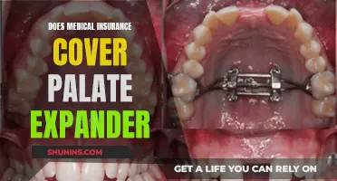 Palate Expanders: Are They Covered by Medical Insurance?
