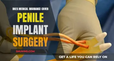 Medical Insurance and Penile Implants: What's Covered?