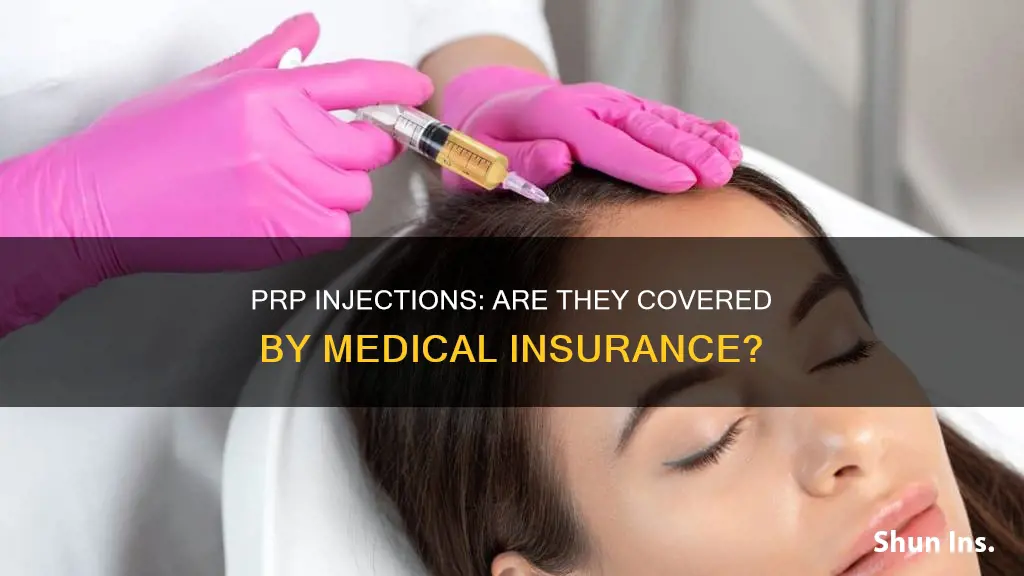 does medical insurance cover prp injections