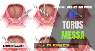 Medical Insurance Coverage for Torus Massa Removal Surgery