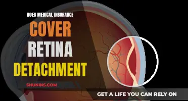 Retina Detachment: Medical Insurance Coverage Explained
