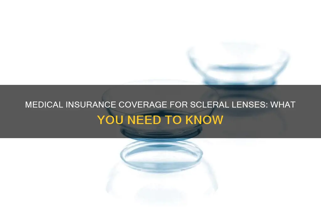 does medical insurance cover scleral lenses