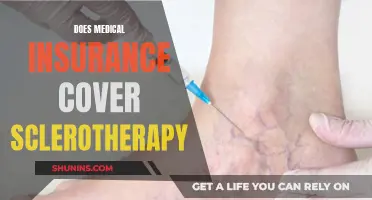 Medical Insurance and Sclerotherapy: What's Covered?