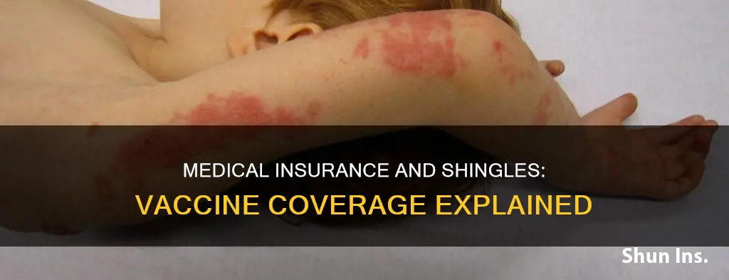 does medical insurance cover shingles vaccine