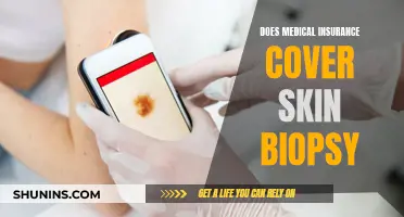 Skin Biopsy: Is Medical Insurance Coverage Guaranteed?