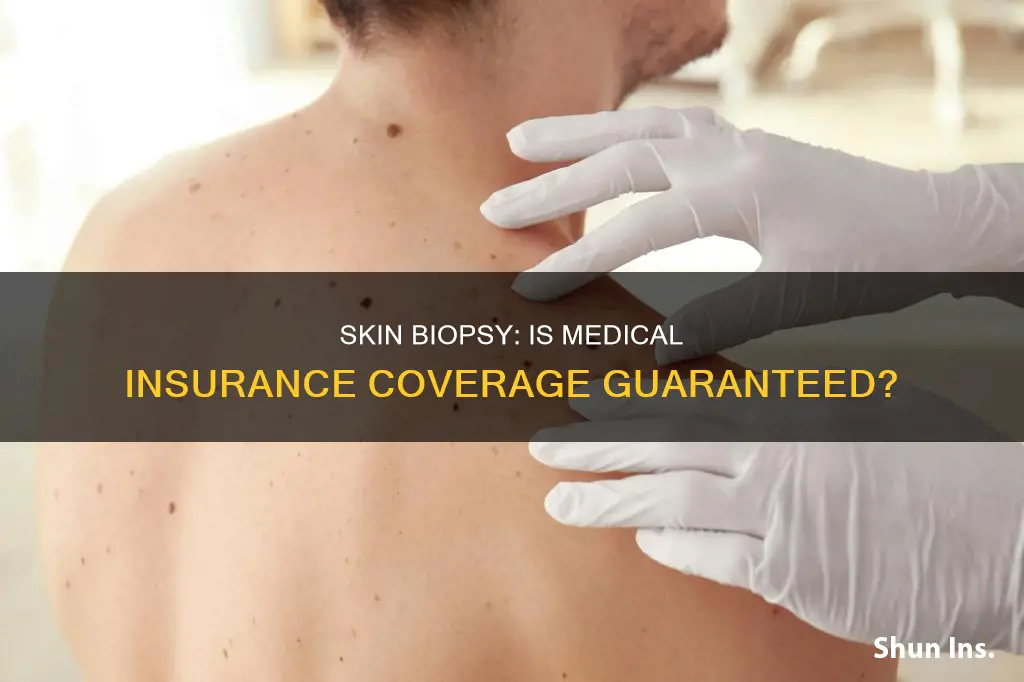 does medical insurance cover skin biopsy