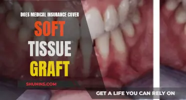 Soft Tissue Grafts: Are They Covered by Medical Insurance?