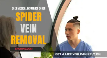 Medical Insurance and Spider Vein Removal: What's Covered?