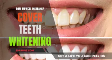 Medical Insurance and Teeth Whitening: What's Covered?