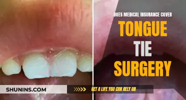 Tongue-Tie Surgery: Is Medical Insurance Coverage Available?